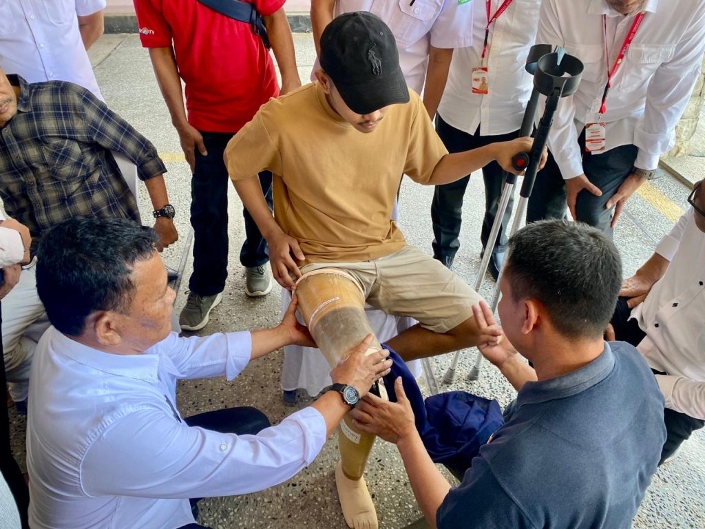Jasa Pembuatan Kaki Palsu Balikpapan