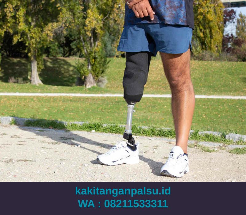 Jasa Pembuatan Kaki Palsu Banda Aceh