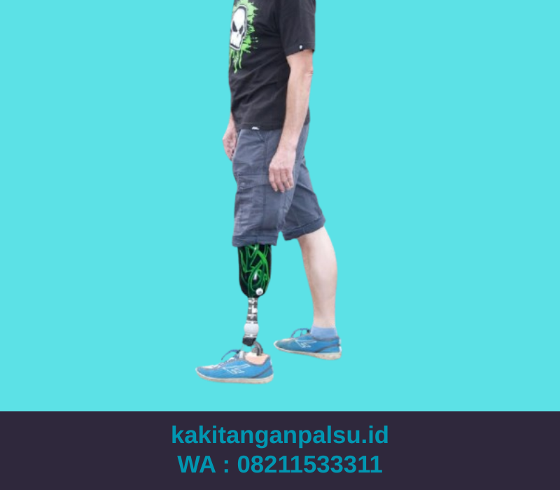 Jasa Pembuatan Kaki Palsu Banjarmasin