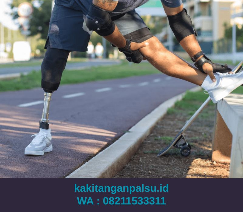 Jasa Pembuatan Kaki Palsu Batam