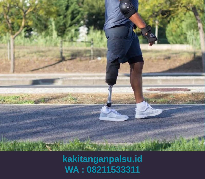 Jasa Pembuatan Kaki Palsu Bogor