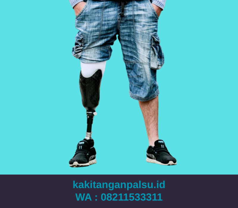 Jasa Pembuatan Kaki Palsu Cikarang