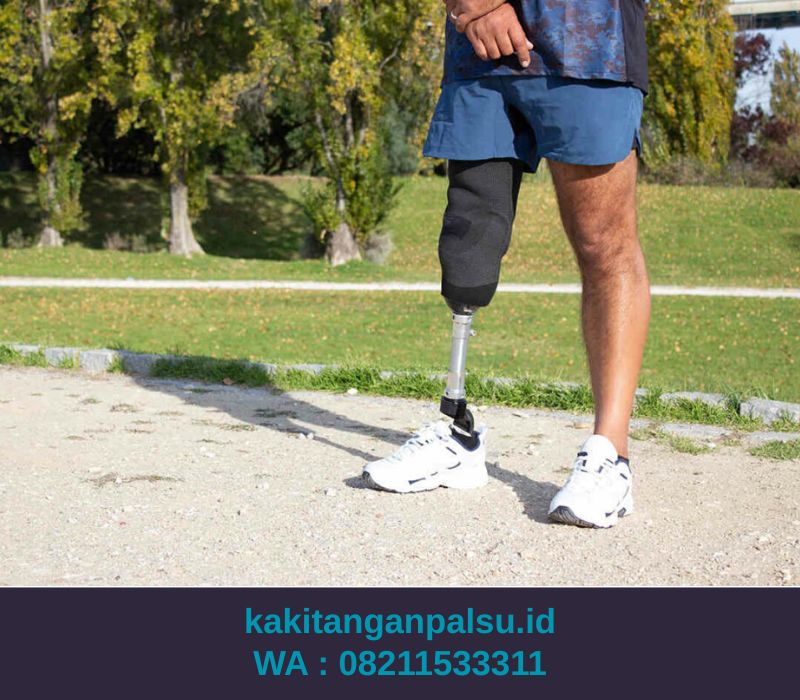 Jasa Pembuatan Kaki Palsu Depok 