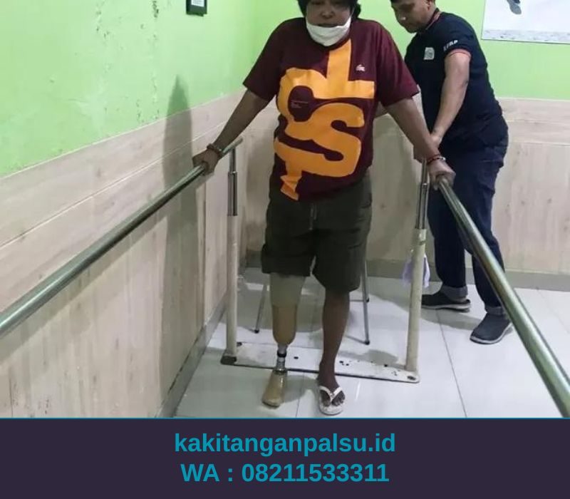 Jasa Pembuatan Kaki Palsu Makassar