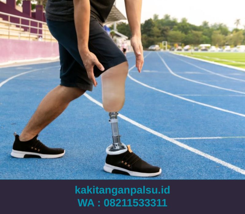Jasa Pembuatan Kaki Palsu Malang