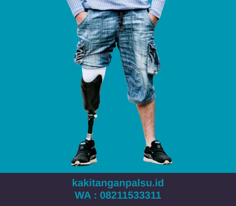 Jasa Pembuatan Kaki Palsu Palembang