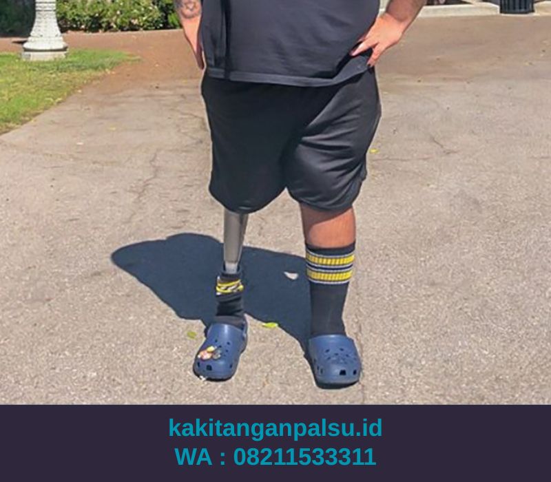 Jasa Pembuatan Kaki Palsu Samarinda
