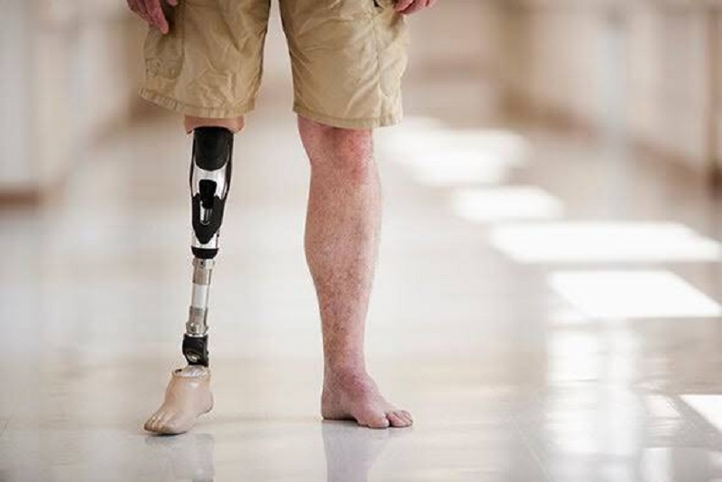 Jasa pembuatan kaki palangkaraya