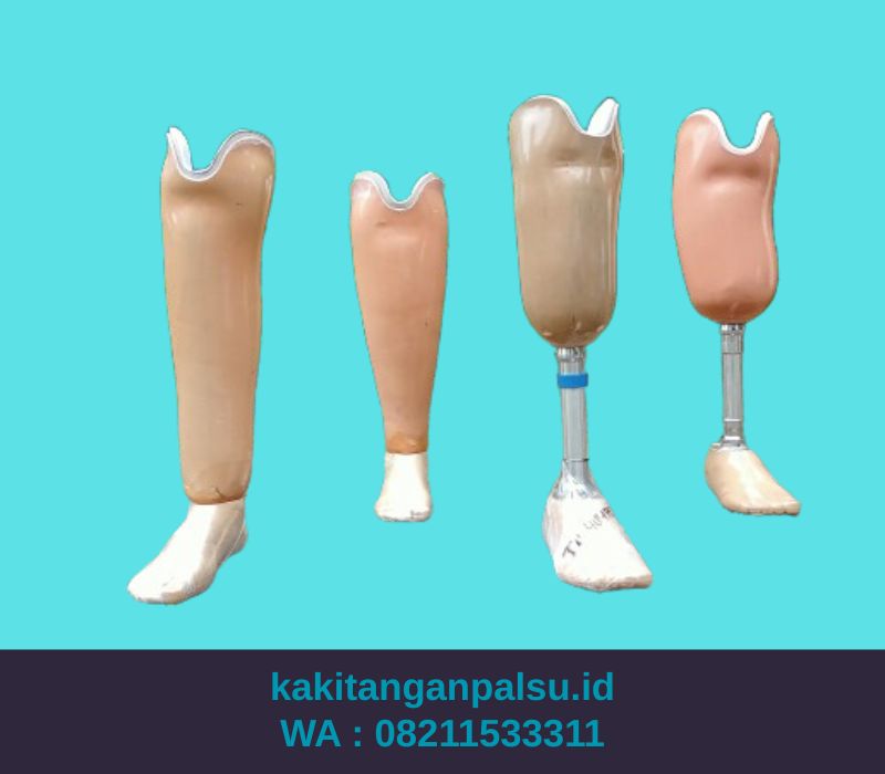 Jual Kaki Palsu Batam