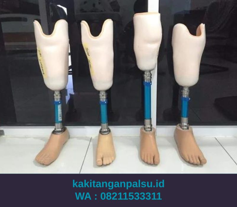 Jual Kaki Palsu Bogor