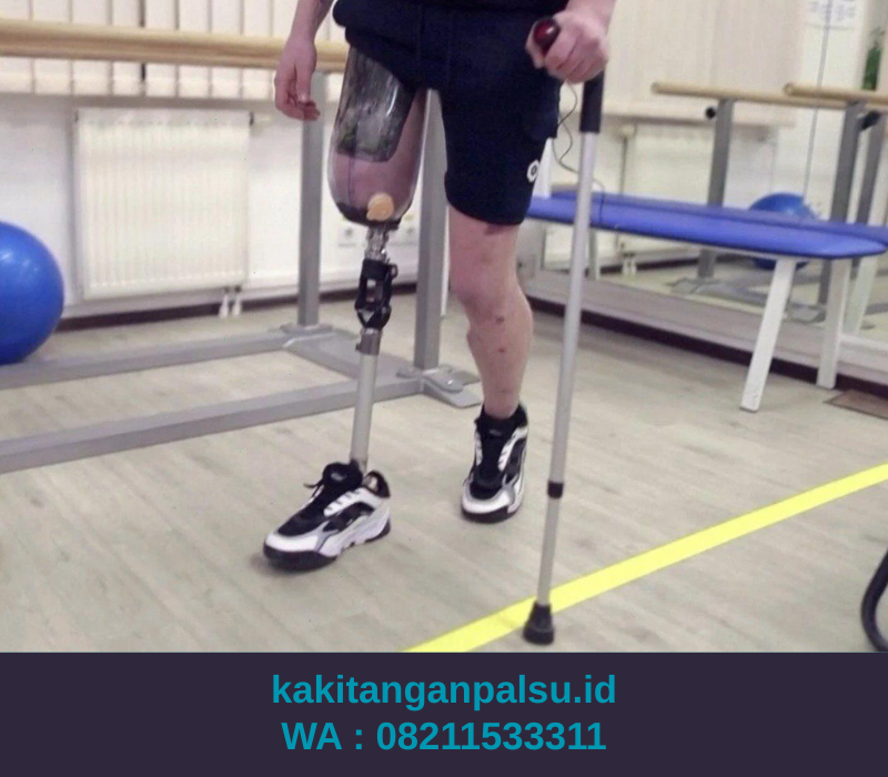 Jual Kaki Palsu Cikarang