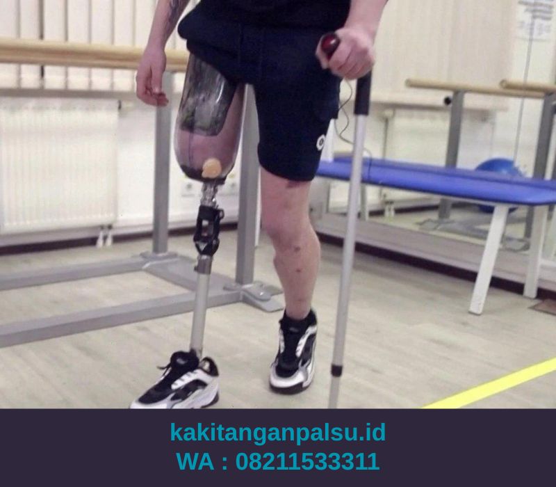 Jual Kaki Palsu Depok 