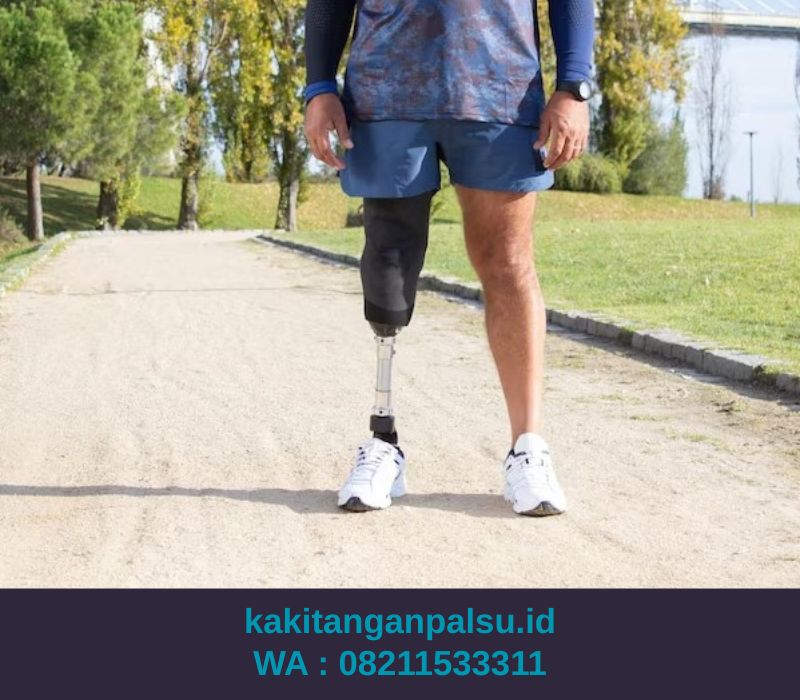 Jual Kaki Palsu Malang