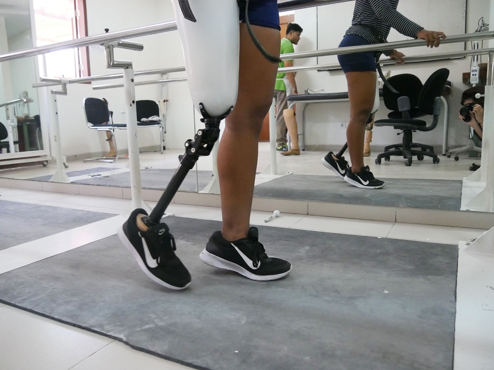 Jual Kaki Palsu Palangkaraya