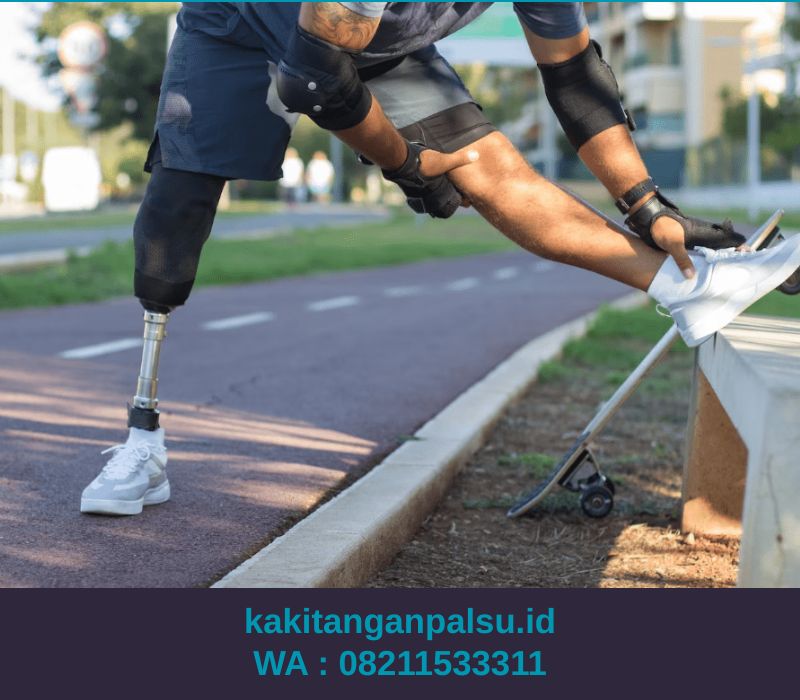 Jual Kaki Palsu Palembang