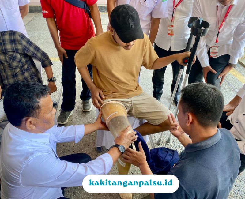 Jual Kaki Palsu Pontianak