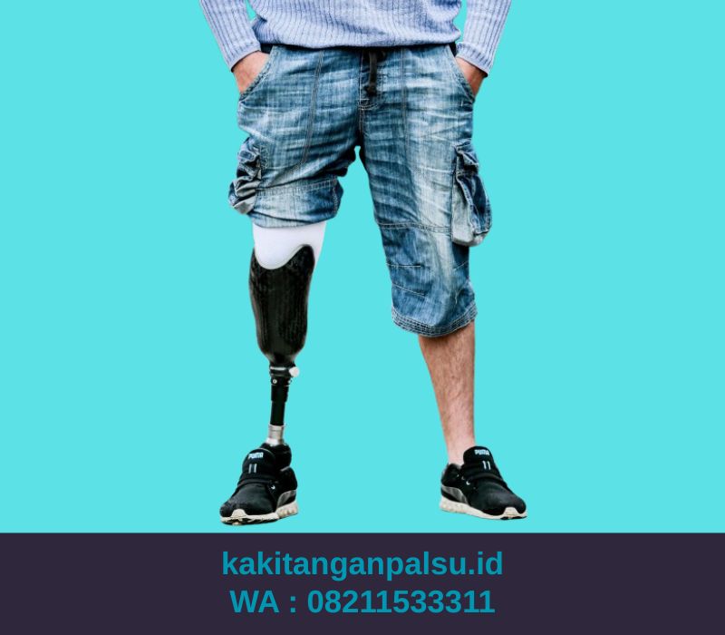 Jual Kaki Palsu Samarinda