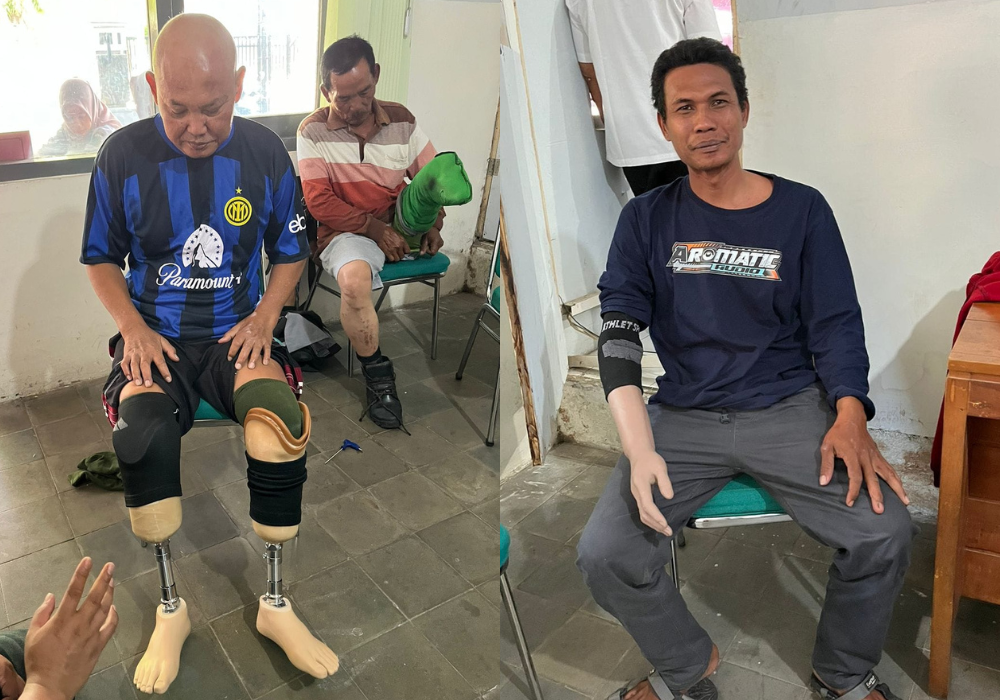 Tempat Jual Kaki Palsu Balikpapan