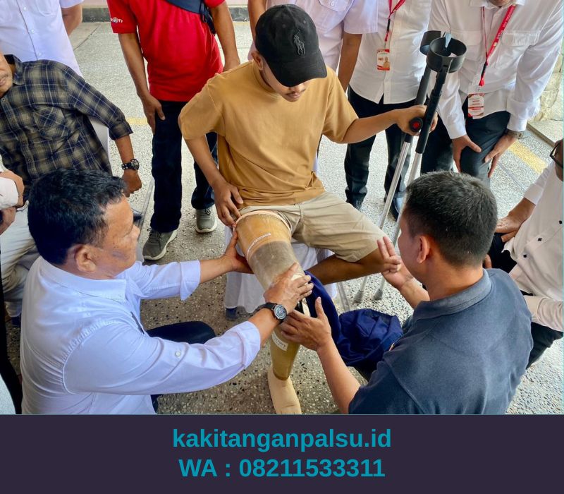 Tempat Jual Kaki Palsu Banda Aceh