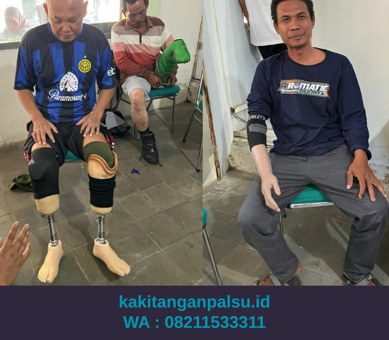 Tempat Jual Kaki Palsu Banjarmasin