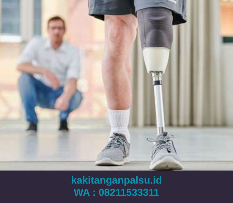 Tempat Jual Kaki Palsu Batam