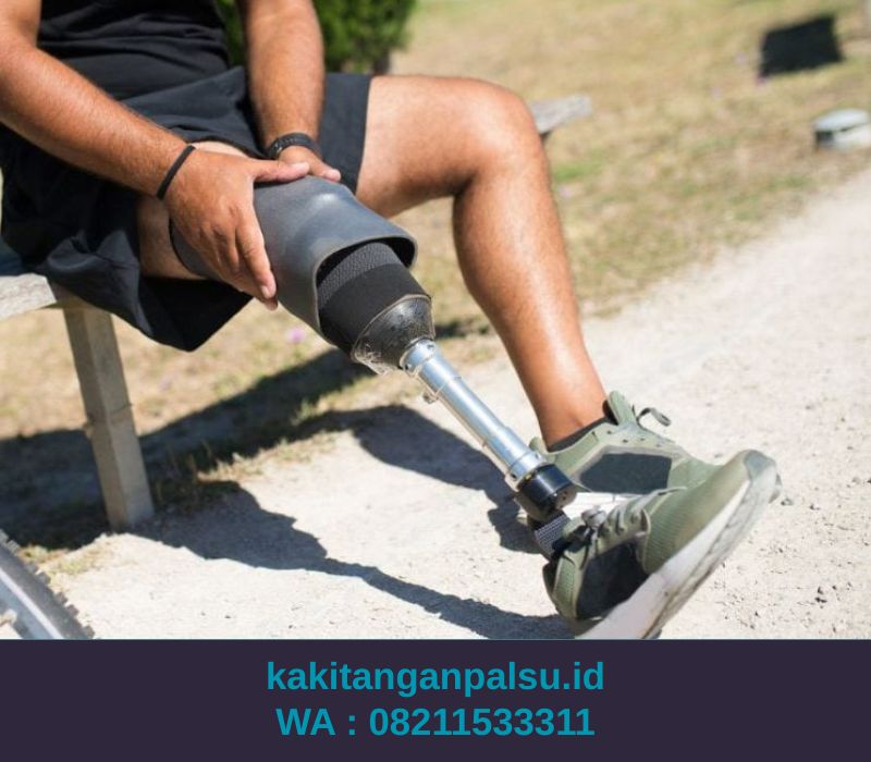 Tempat Jual Kaki Palsu Bogor