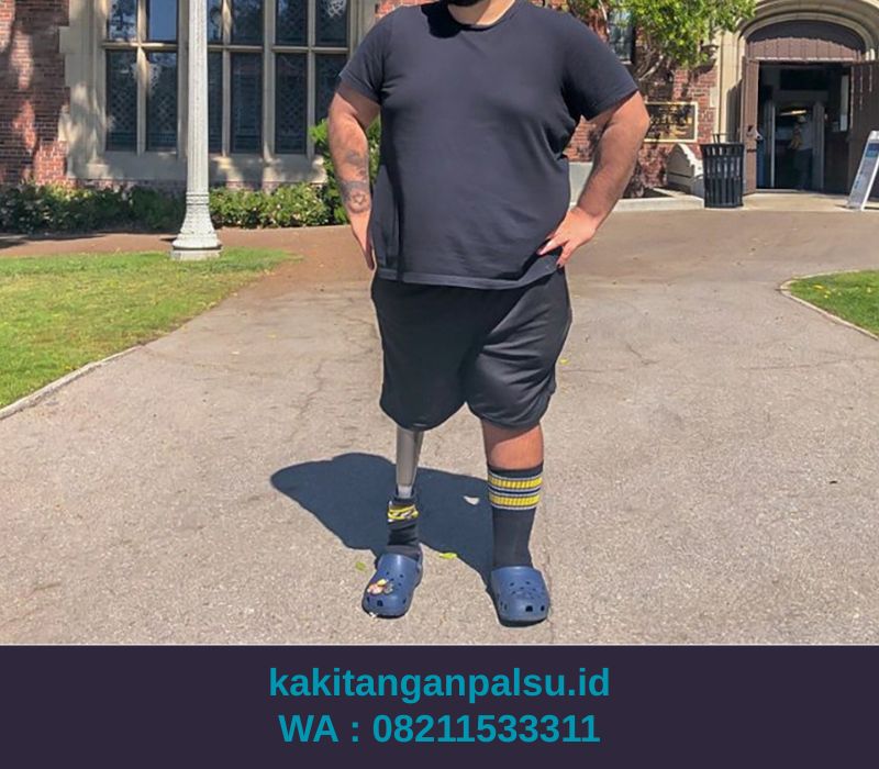 Tempat Jual Kaki Palsu Depok