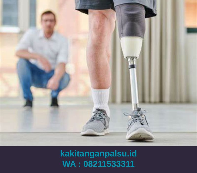 Tempat Jual Kaki Palsu Malang