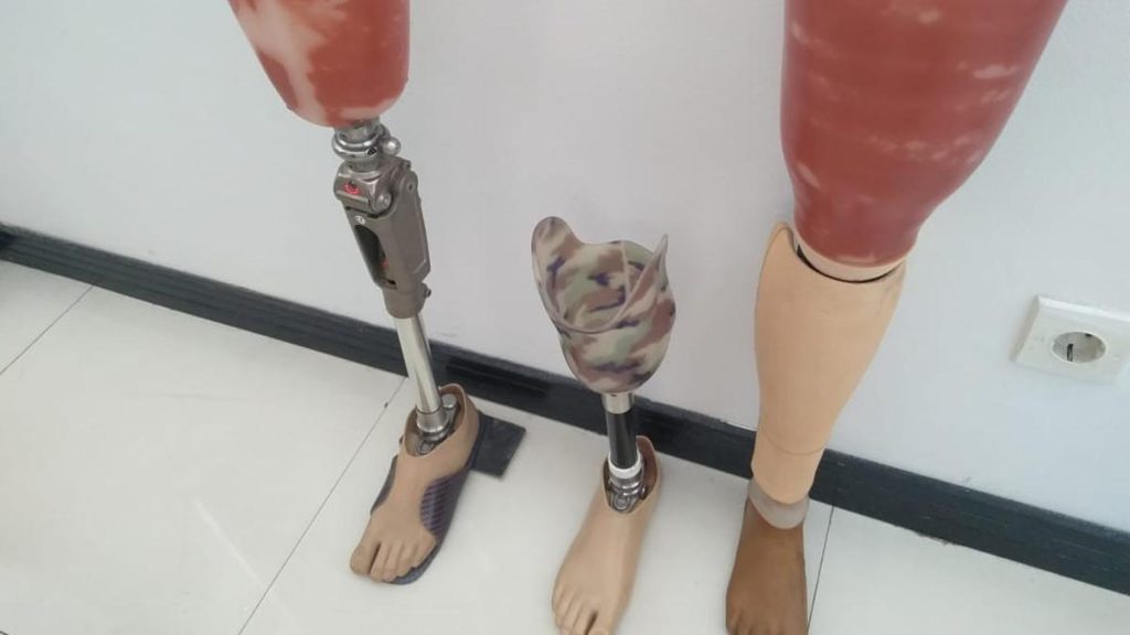 Tempat Jual Kaki Palsu Palangkaraya