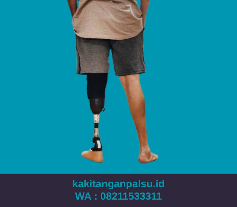 Tempat Jual Kaki Palsu Palembang