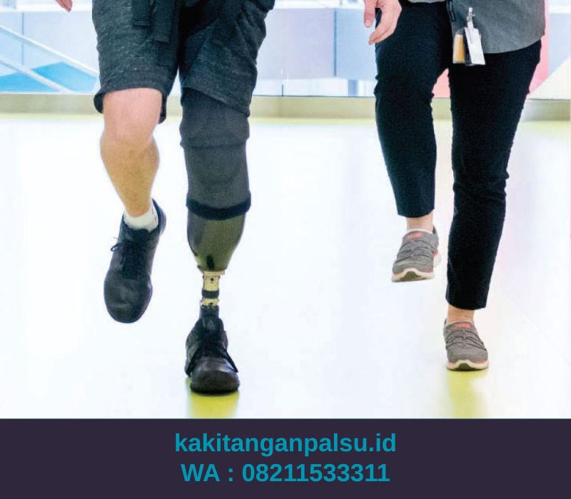 Tempat Jual Kaki Palsu Samarinda